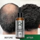 thumbnail image 4 of Rosemary Infused Scalp Treatment, 50ml for Strong and Hydrated Hair, 4 of 5