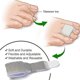 thumbnail image 2 of hammer toe correctors 6 pack for straightening toes, 2 of 4