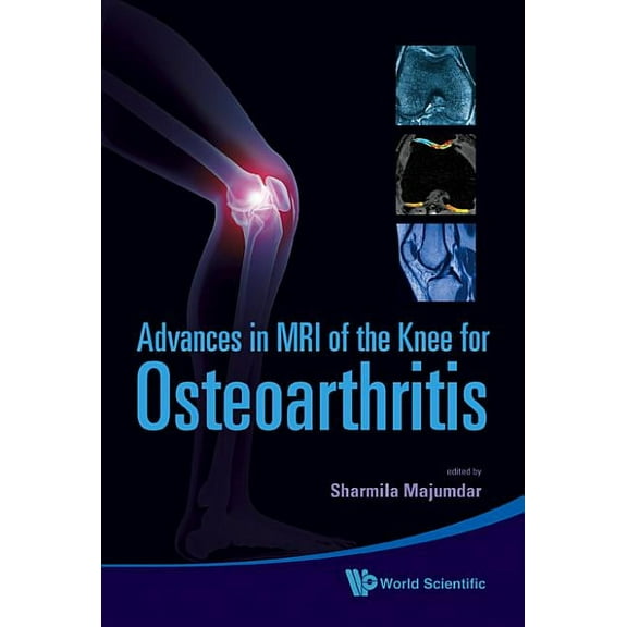 Adv in MRI of the Knee for Osteoarthriti, (Hardcover)