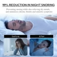 Mouth Tape for Sleeping Snore Stopper Mouth Breathing Snoring Tape