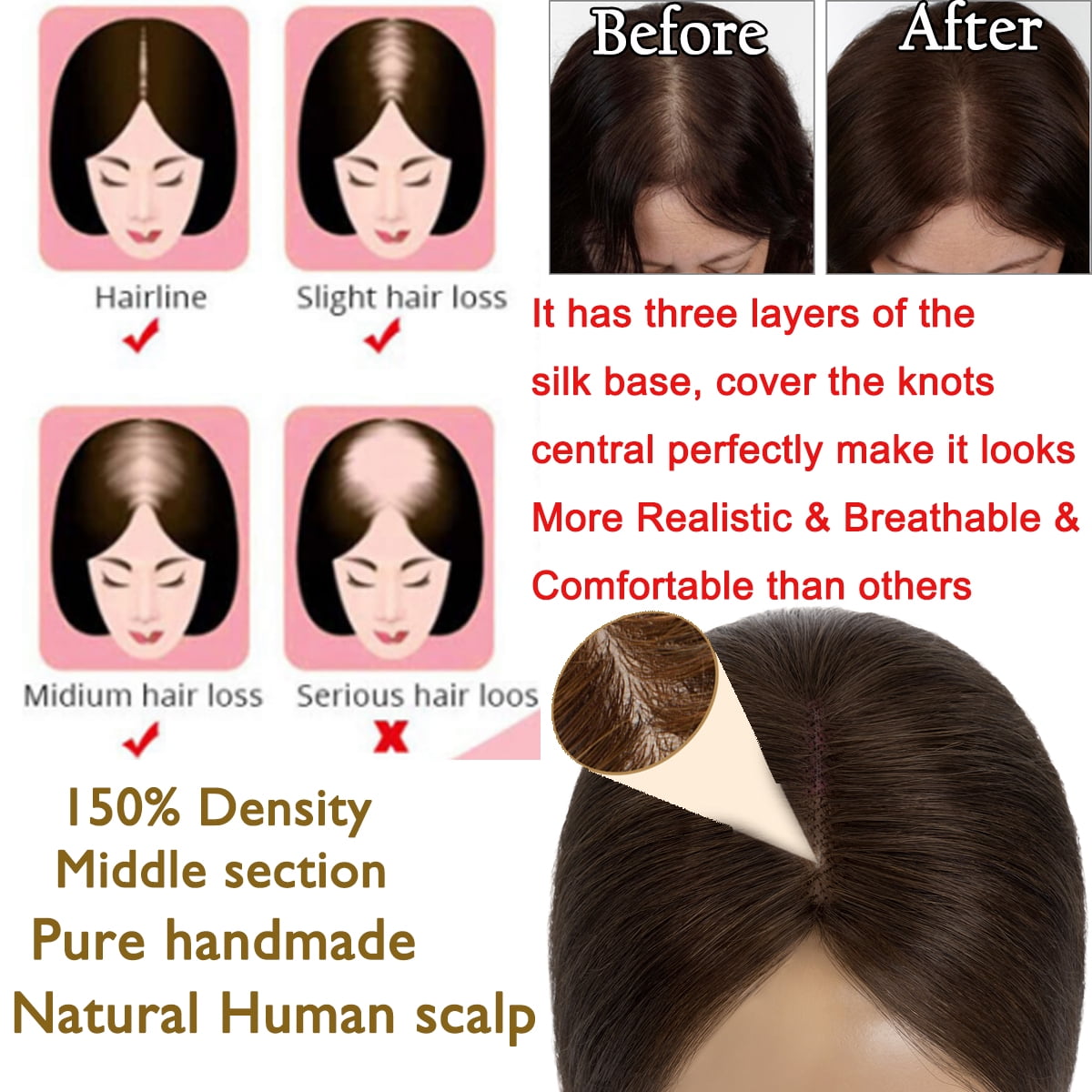 12 Inch Human Hair Topper, Realistic Scalp, Clip-In for Thinning Hair Amazon.com : Hair Toppers for Women 12 Inch Human Hair  main image 3