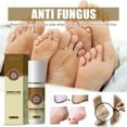 thumbnail image 4 of Athletes Foot Spray - Extra Strength - Natural Ingredients Itchy Skin Relief, Ringworm, Jock Itch, Odor | Apple Cider Vinegar Remedy for Men, Women, 4 of 6