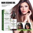 thumbnail image 2 of Shelure Hair Regrowth Treatment Oil For Dry Damaged Nourishmen Hair Scalp 2024 New, 2 of 5