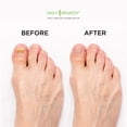 thumbnail image 4 of Aceite de árbol de té extra fuerte para remojo de pies con sal de Epsom, fabricado en Estados Unidos, para uñas de los pies, pie de atleta, picazón en los pies, olor persistente y maloliente, pedicura, 4 of 7