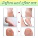 thumbnail image 5 of XIMONTH 10pcs Foot Bath Tablets Bubble Tablets Remove Dead Skin Fatigue and Foot Odor Keeping Your Feet Fresh Clean and Fragrant, 5 of 5