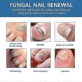thumbnail image 3 of Extra Strong Fungal Nail Treatment - Effective Solution For Finger & Toenail Fungus, Protects Thick, Broken, Discolored Nails, Restores Discolored Nai, 3 of 5