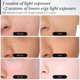 thumbnail image 5 of Mascarilla facial LED con terapia de luz roja, 7 colores para rostro, 5 of 9