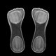 thumbnail image 2 of Almohadilla de silicona transparente de 7 puntos (color transparente) , 2 of 4