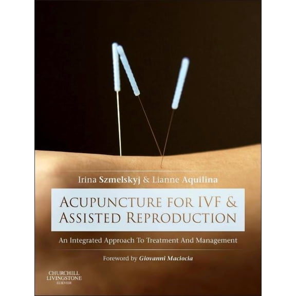 Acupuncture for Ivf and Assisted Reproduction: An Integrated Approach to Treatment and Management, (Hardcover)