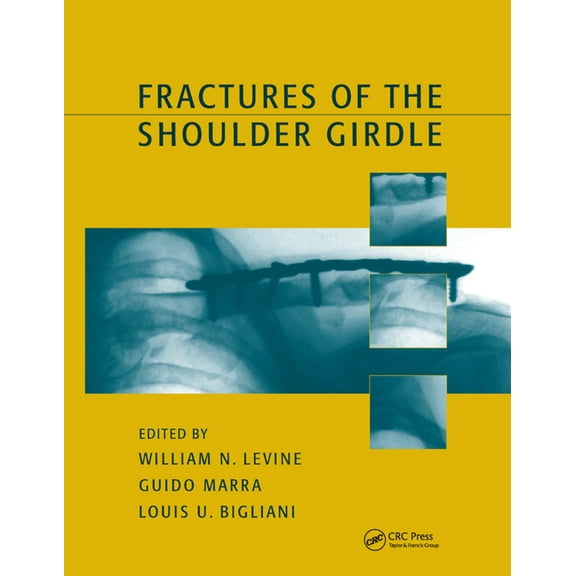 Fractures of the Shoulder Girdle, (Paperback)