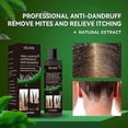 thumbnail image 4 of 100ml Scalp Ringworm Anti-itch Shampoo Dandruff Control Oil Anti-itch Shampoo Anti-loss Oil Control Refreshing Shampoo, 4 of 5