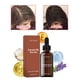 thumbnail image 5 of Acondicionador capilar de 30 ml con aceite esencial, extracto de aceite de ricino y aceite de jengibre. Contiene cúrcuma, extracto de mungo y aceite de ricino., 5 of 9