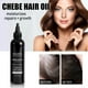 thumbnail image 1 of Ganfancp Aceite de Vieira, para Cabello Seco Dañado, Picor Del Cuero Cabelludo, Crecimiento Del Cabello, Aceite Capilar,118Ml Ofertas Del Día Liquidación 1X Aceite para El Cabello, 1 of 7