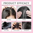 thumbnail image 4 of 2-in-1 Scalp Scrub Onion Scalp Exfoliator Shampoo with Sea Salt, Deep Cleanse & Hair Growth Treatment for Men Women, 100g, 4 of 5