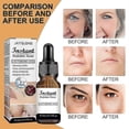 thumbnail image 2 of Jaysuing Anti-Wrinkle Essence Hydrates, Moisturizes, Shrinks, Brightens Skin, Reduces Wrinkles, Firms and Repairs Skin, 2 of 5