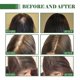 thumbnail image 5 of Batana Oil for Hair Growth, 100% Pure Batana Oil Natural Hair Growth Treatment Oil cares for hair thickness and scalp and prevents hair loss, 5 of 5
