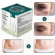 thumbnail image 2 of Silicone Scar Sheets for Post-Surgery, C-Section, Burns, and Keloids - 4cm x 3m Roll, 2 of 5