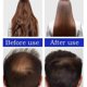thumbnail image 5 of Mascarilla capilar de aceite de batana puro natural para el crecimiento del cabello. Tratamiento para la caída del cabello en hombres y mujeres de raza negra., 5 of 5