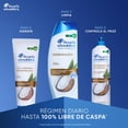 thumbnail image 4 of Acondicionador Head & Shoulders Hidratación Control Caspa 300 ml, 4 of 5
