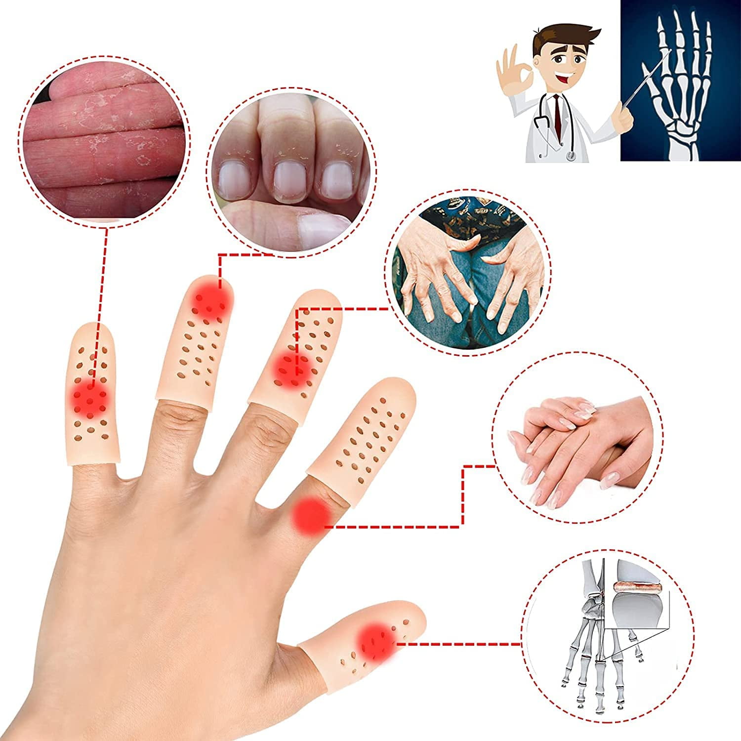 Protecteurs De Doigts En Silicone Gel Finger Cots – Bandages Pour Bout Des Doigts – Neuf