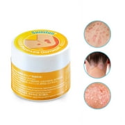 Hydrocortisone 1% Anti Itch Cream - Maximum Strength Instant Itch Relief Cream for Mosquito Bites, Eczema, Dermatitis