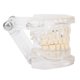 thumbnail image 4 of Simulador de dientes transparente para demostraciones educativas Modelo dental acrílico, 4 of 8
