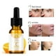 thumbnail image 1 of Hot6sl Ofertas de La Semana Suero Liquido Antienzima Vitamina C y Aceite Blanqueador Vc 10 Ml, 1 of 7