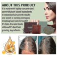 thumbnail image 2 of OUHOE shampoo and hair care soap cleaning hair moisturizing scalp repair damaged hair quality reducing hair loss and hair, 2 of 3