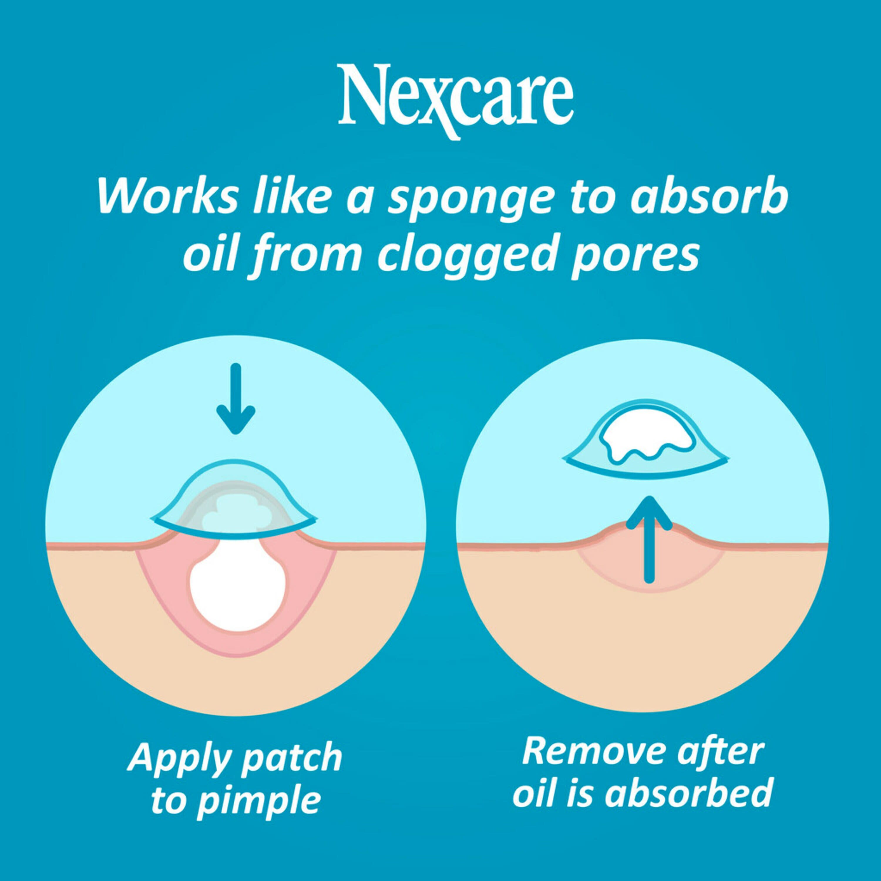 Nexcare Acne Cover for Clogged Pores - 36 Acne Covers - image 3 of 8