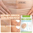 thumbnail image 5 of Silicone Gel Sheet Patch Scar Removal Self Adhesive Skin Repair Treatment Tape, 5 of 5