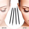 thumbnail image 2 of Pimple Popper Tool Kit, Comedone Blackhead Remover Zit Blackhead Extractor Tool for Nose Face, Blackhead Needle Acne Needle Beauty Tool Candy Color Tool Kit. (4Pcs Set) (Green), 2 of 3
