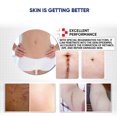 thumbnail image 4 of Scar Removal Lavender Cream For , Stretch Marks, Burn Skin Bio Regulation, Nourishing, 4 of 8