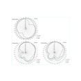 thumbnail image 4 of Maswell 3 Combo GPS+LTE MIMO +WiFi AN_GPS_MIMO_WIFI_604 Antenna, 4 of 6