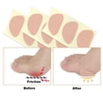 thumbnail image 3 of Cheers.US 30Pcs/Set Corn Pads for Foot, Soft Breathable Foot Pads for Calluses, Cotton Cushions for Bottom of Feet Pain Relief Men and Women Foot Care, 3 of 7