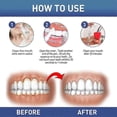 thumbnail image 5 of 3Pcs DentiZen Gum Therapy Gel, Gum Instant Soothing Gels, for Sensitive Teeth Pen New Arrival, 5 of 5
