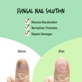 thumbnail image 4 of Kiss New York Nail Strengthening Treatment, Infused with Biotin, Propolis, Tea Tree Oil, Fingernail and Toenail, Eliminate Discoloration, Made in Korea, 4 of 8
