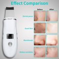 thumbnail image 3 of Herramienta de limpieza profunda Skin Scrubber QYCSL 4 en 1, color blanco, 3 of 7