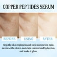 thumbnail image 4 of Suero de péptidos de cobre Péptido de cobre azul Reafirmante Facial Envejecimiento de la piel Hidratante 30 ml lo esencial, 4 of 5