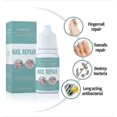 thumbnail image 4 of Fungal Nail Solution for Toenails - Fixes Discolored Nails, Safe & Effective - Anti Fungus Oil for Ingrown Toenails, 4 of 5