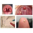 thumbnail image 5 of Led Earwax Removal Tool Kit Stainless Steel Earpick Tonsil Stone Extractor, 5 of 5