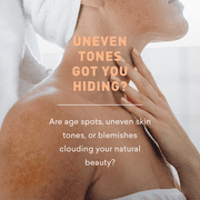 Just Nutritive Even Skin Tone Correcting Treatment, Diminishes Dark Spots, Scars, Stretch Marks, for Balanced, 8oz