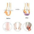 thumbnail image 4 of PCSsole’s 3/4 Orthotics Shoe Insoles High Arch Supports Shoe Insoles for Plantar Fasciitis, Flat Feet, Over-Pronation, Relief Heel Spur Pain（XL）, 4 of 9