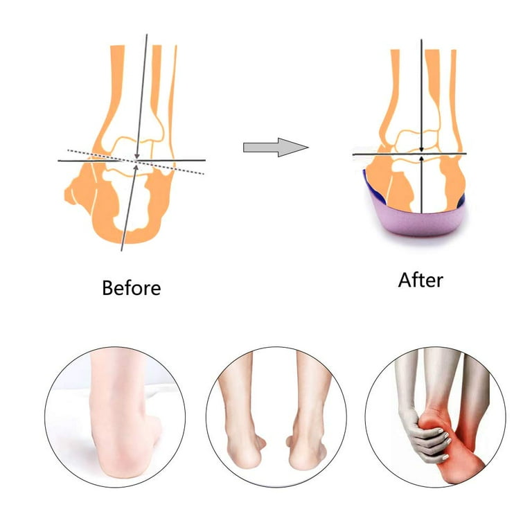 high arch pronation shoes