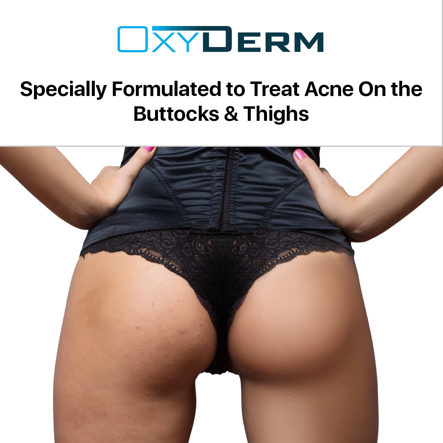 Butt & thigh Acne Treatment Pads - Exfoliating Pads to Eliminate Acne Causing Bacteria. Removes Pimples, Blemishes & Ingrown Hairs for the Buttocks & Thigh Area for Both Men & Women.