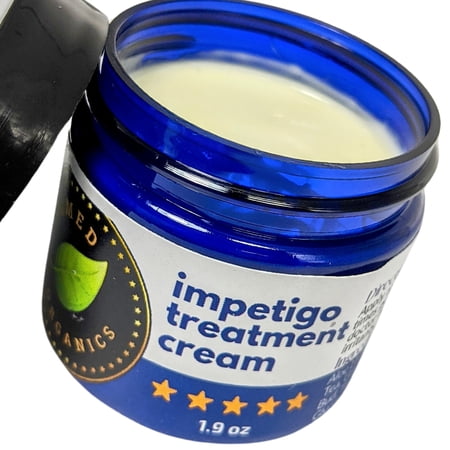 Impetigo Natural Topical Relief Treatment Cream Over The Counter by Tamed Organics Brand