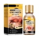 thumbnail image 1 of Great promotion Essential oils Essential Oil Bee Gynecomastia Heating Oil, Best Men Bee Oil, Men Oil, Men Bee Oil, Gynecomastia Tightening Oil For Men 15ml(buy 2 get 10% off), 1 of 5