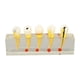 thumbnail image 3 of Modelo De Caries Dental, Modelo De Dientes Estudio Dental Implante Transparente Modelo De Caries Dental Para Enseñanza Dental, 3 of 5
