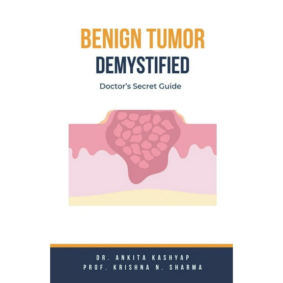 Benign Tumor Demystified: Doctor's Secret Guide, (Paperback)