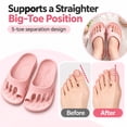 thumbnail image 6 of Five Toe Shoes for Women with Arch Support, Cushioned Toe Separator Slides for Home and Outdoor Walking, 6 of 7