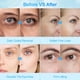 thumbnail image 3 of Parches Antiedad para Ojos (60 Unidades) | Combate Ojeras, Bolsas y Arrugas | Reafirmante, Hidratante, Antioxidante y de Larga Duración | Tamaño de 80 G, 3 of 7
